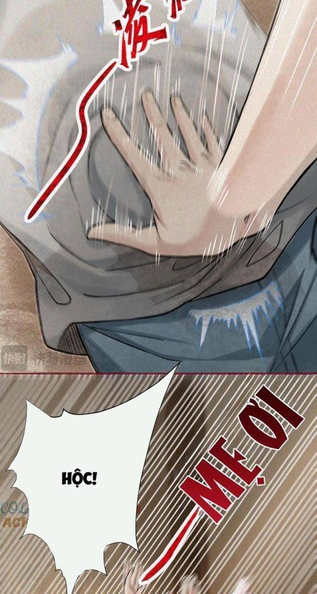 Làm Người Nhặt Xác, Tôi Khởi Đầu Là Giải Phẫu Bạn Gái Cũ! - Page 73