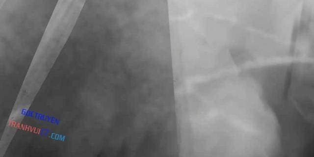 Sát Thủ Áo Đỏ - Page 169